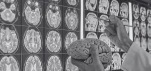 Neurológo analizando resonancias cerebrales durante la especialidad de Neurología en Alemania
