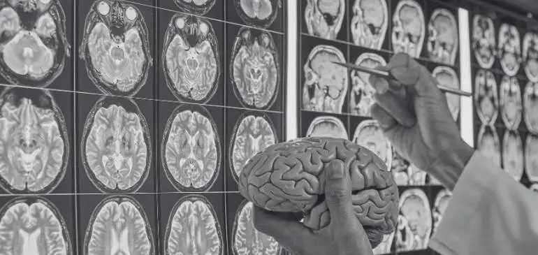 Neurológo analizando resonancias cerebrales durante la especialidad de Neurología en Alemania